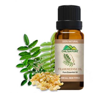 Frankincense-oil