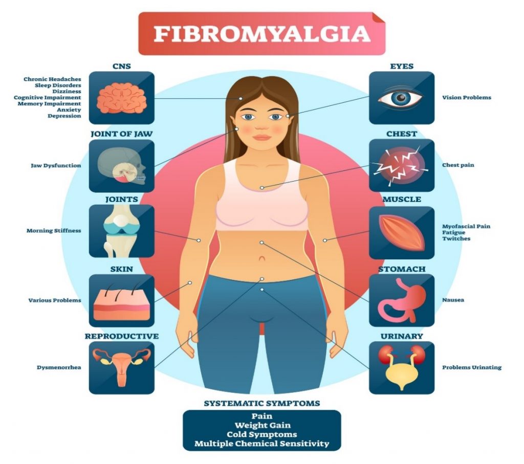 Fibromyalgia symptoms